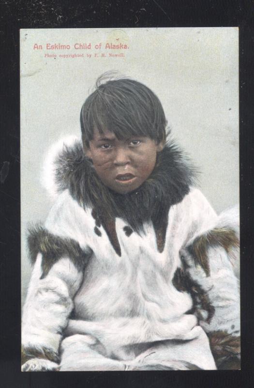 AN ESKIMO CHOLD OF ALASKA ANTIQUE VINTAGE POSTCARD CUTE GIRL