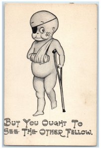 Little Boy Injured Undressed But You Ought To See The Other Fellow Postcard