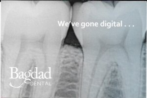 US Post Card #4595  Kilauea.  Dental Ad