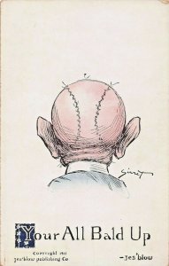 YOUR ALL BALD UP-MAN'S HEAD LOOKS LIKE BASEBALL-1911 JES BLOW PUBL POSTCARD