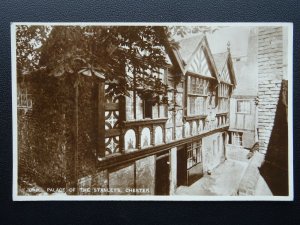 Cheshire CHESTER Palace of the Stanley's - Old RP Postcard