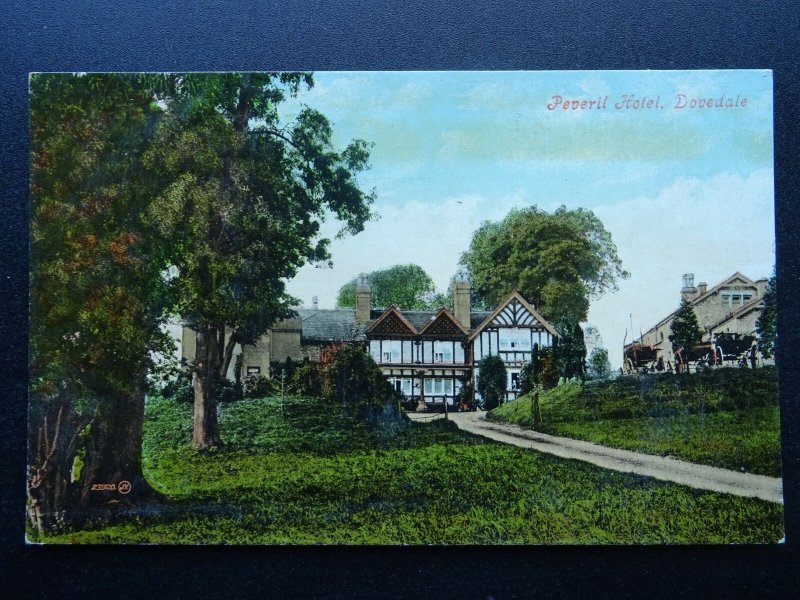 Derbyshire DOVEDALE Peveril Hotel - Old Postcard by Valentine 23920