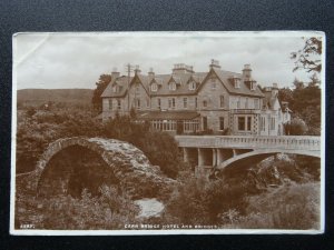 Scotland Carrbridge CARR BRIDGE HOTEL & BRIDGES - Old RP Postcard by J.B. White