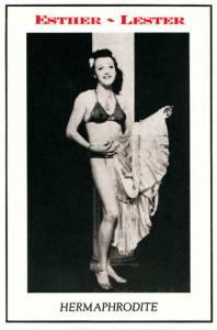 Esther - Lester Hermaphrodite Circus Sideshow Modern Postcard
