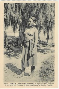 ASIA ETHNIC NUDE INDOCHINA VIETNAM ANNAM WOMAN MOÏS BARE BREASTS