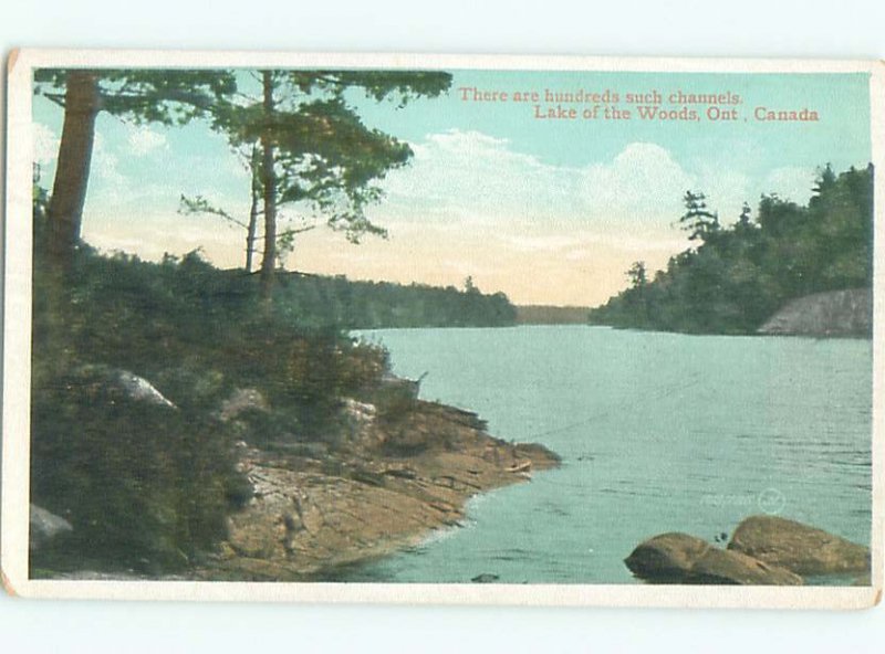 W-border LAKE SCENE Lake Of The Woods - Kenora Ontario ON AE4752