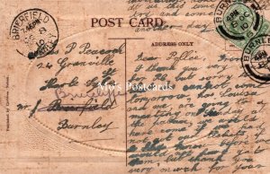 Lancashire Postcard - The Hospital, Burnley   SW18214