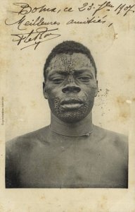 Congo Free State, Native Man Facial Tattoo Scarification (1907) Postcard