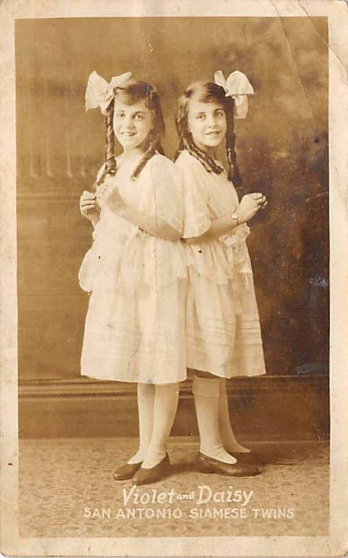 Violet And Daisy Violet And Daisy San Antonia Texas Usa Siamese Twins View I Topics