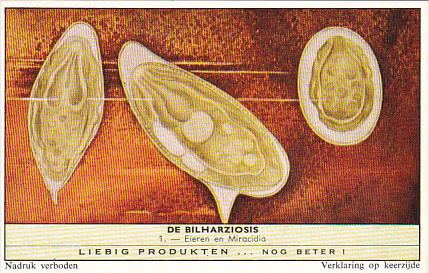 Liebig Trade Card s1751 Bilharziosis Parasite Disease No 1 Eieren en Miracidia