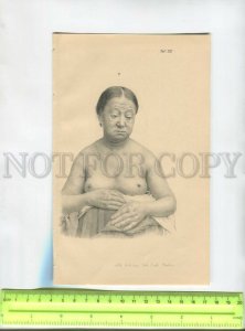 476293 Semi-nude elderly Victorian woman Vintage poster phototype