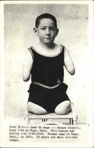 Disabled Boy No Arms Legs Edward Kissell Cirucs Freak Barnum Bailey Hugo OK RP