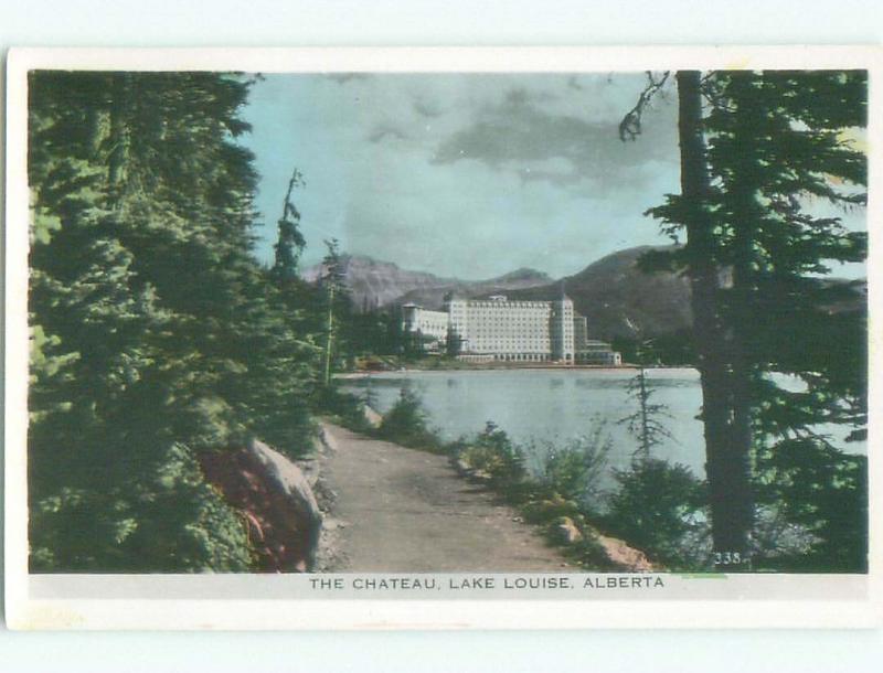 1950's rppc NICE VIEW Lake Louise Alberta AB W0917