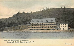 CANADA LAKE NEW YORK~AUSKERADA HOTEL~1905 ROTOGRAPH HANDCOLORED PHOTO POSTCARD