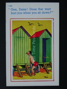 Peeping Tom & Bathing Hut DOES THAT WARD HURT Comic Postcard by Brook Co Ltd