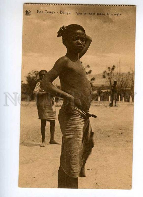 Retro Nudist Gallery - 247410 Bas Congo Bangu semi-nude young black boy Vintage PC | Africa -  Congo - Democratic Republic, Postcard / HipPostcard