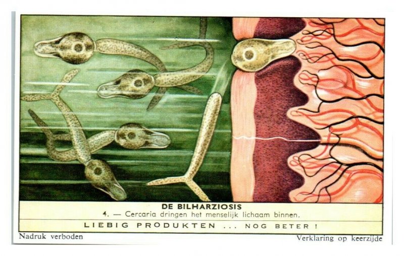 Cercaria Invade Humans Schistosomiasis Bilharziosis Liebig Belgian Trade Card