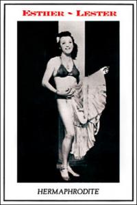 Esther - Lester Hermaphrodite Sideshow Act Postcard