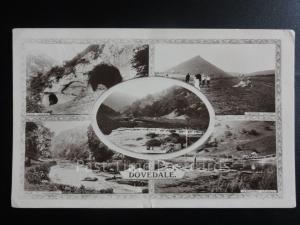 Derbyshire: Dovedale Multiview RP c1920 Pub by Kingsway Real Photo Series