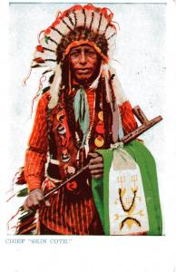 Chief Skin Cote, Undivided Back, pre-1907