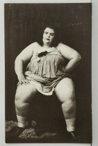 Obese Woman Is Summer Over Yet? Alma Dreads Bikini Season Postcard P8