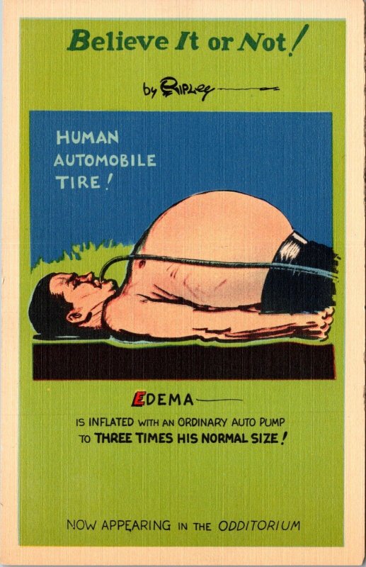 Edema Human  Tire Freak Odditorium Ripley's NY World's Fair 1940 Postcard