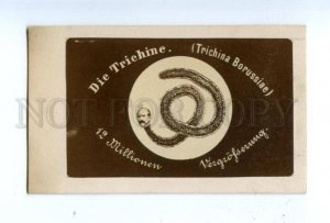 167296 Otto von BISMARCK as parasitic roundworms PROPAGANDA