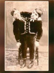 Siamese Twins Twin Boys Circus Sideshow Performers Modern...