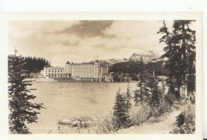 Canada Postcard - Chateau Lake Louise - Near Banff - Real Photo - Ref 14986A