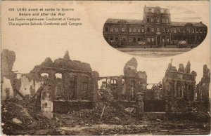 CPA LENS avant et aprés le Guerre-Before and after the War (44144)