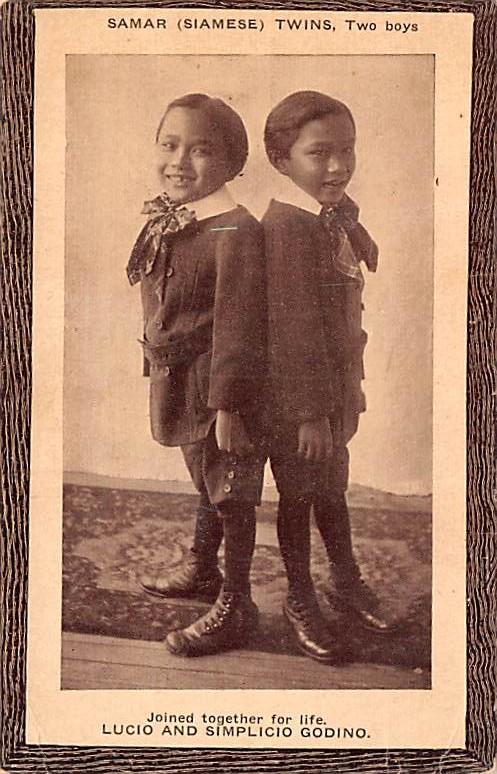 Samar Siamese Twins, Two Boys Luci and Simplicio Godino Unused very light  cr...