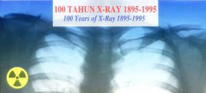 1995 X-rays.