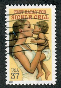 3877 Sickle Cell used single