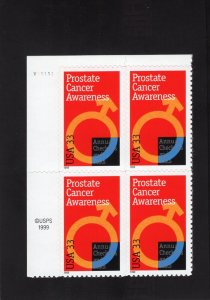 3315 Prostate Cancer, MNH UL-PB/4 (#V11111)