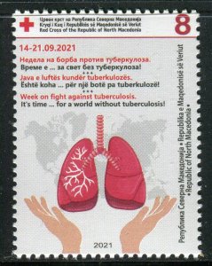 300 - NORTH MACEDONIA 2021- Fight Against Tuberculosis - Surcharge Stamp - MNH