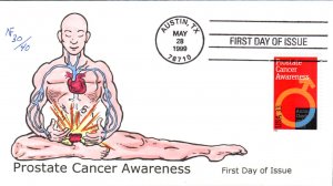 #3315 Prostate Cancer Awareness Faircloth FDC