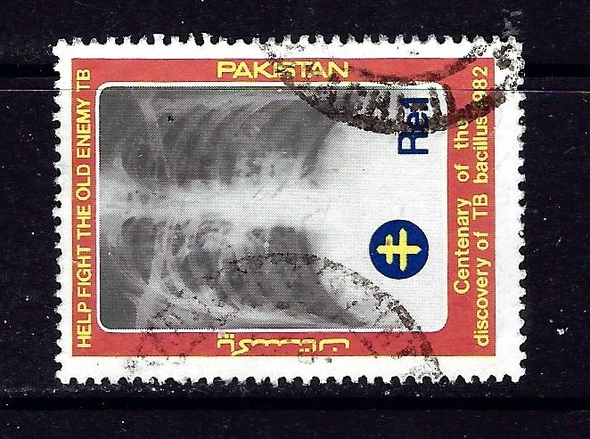 Pakistan 567 Used 1982 X-ray