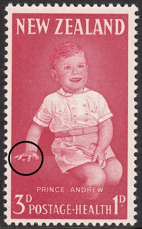 New Zealand 1963 3d+1d Health Stamp Bloodstained Finger Variety MUH