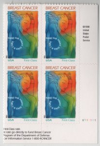 B1 Breast Cancer Semiostal V111111LL Plate Block