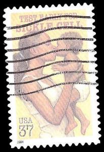 # 3877 USED SICKLE CELL ANNEMIA