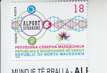 2019 Macedonia ALport Syndrome Awareness    (Scott 827) MNH