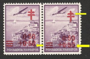 YUGOSLAVIA-MNH PAIR,0.50+0.50/5-TUBERCULOSIS-ERROR, DIFFERENT POSITION OVPT-1940