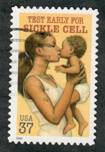 3877 Sickle Cell used single