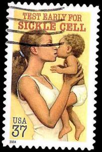 # 3877 USED SICKLE CELL ANNEMIA
