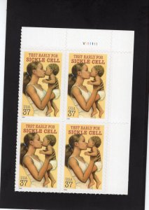 3877 Sickle Cell, MNH UR-PB/4 (#V111111)