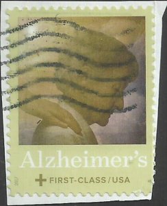 # B6 USED Alzheimers