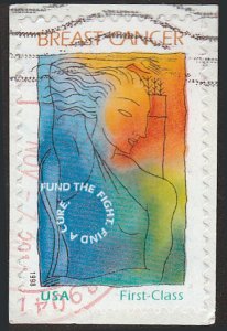 # B1 USED BREAST CANCER RESEARCH