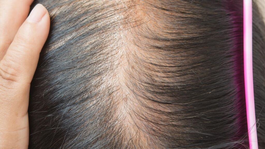 The natural extract that reduces The natural extract that reduces