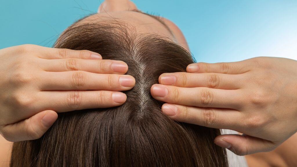 What does a healthy scalp look like?