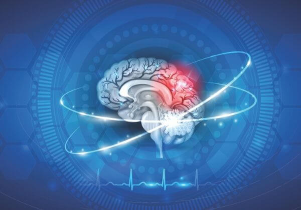 What is a Stroke? - Heart Disorders - 1MD